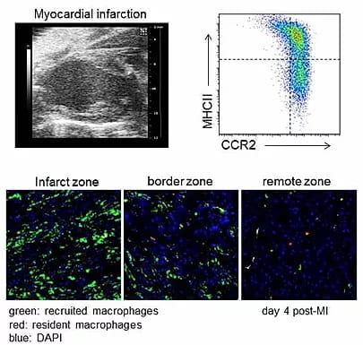 CCR2 and recruited and resident cardiac macrophage changes in recruitment following a myocardial infarction (MI).