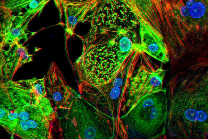 A study from Washington University School of Medicine in St. Louis provides evidence that the coronavirus that causes COVID-19 can invade and replicate inside heart muscle cells, causing cell death and interfering with heart muscle contraction. The image of engineered heart tissue shows human heart muscle cells (red) infected with SARS-CoV-2 (green).